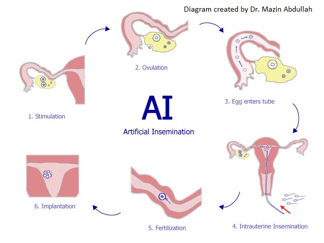 Artificial-Insemination-how-it-works ksa